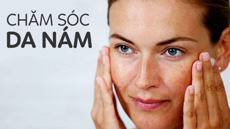 cách chăm sóc da nám vào mùa đông