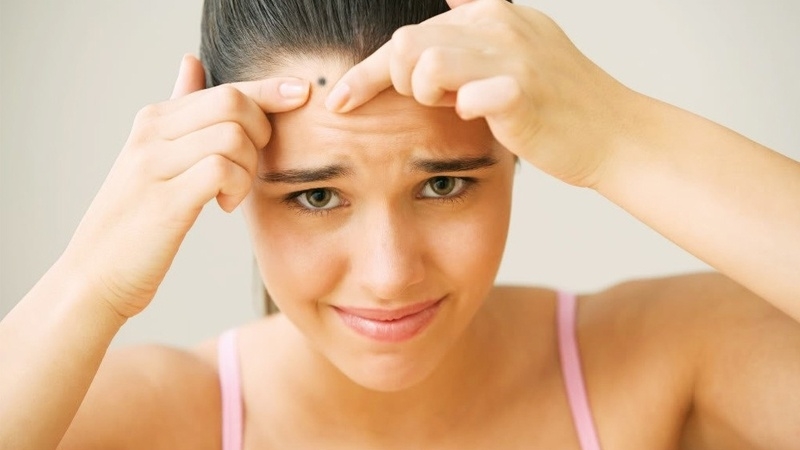 Tẩy nốt ruồi có nguy hiểm không?