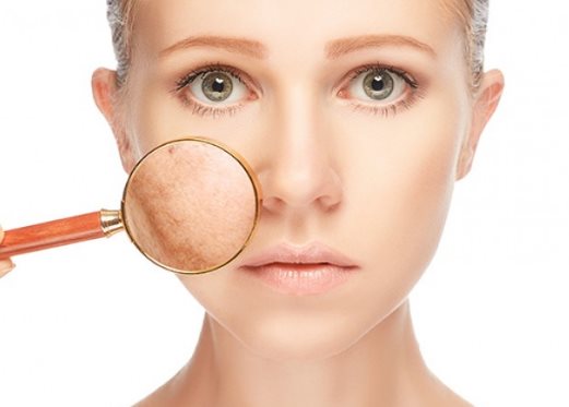 Tại sao phải điều trị nám từ sớm