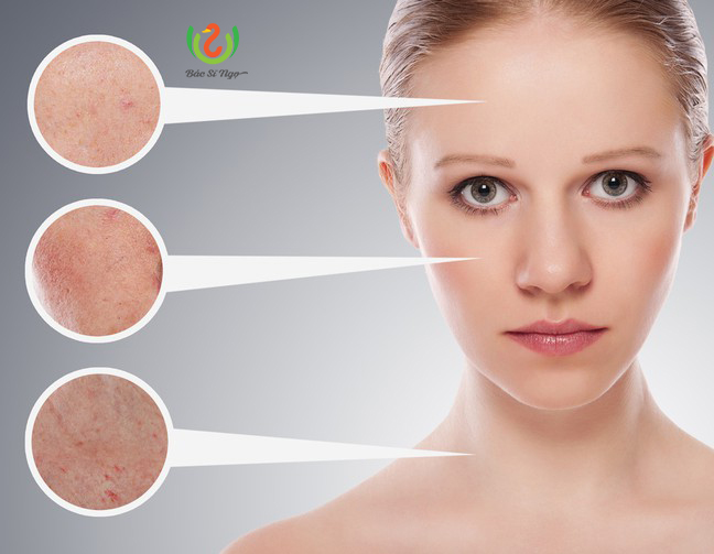 Tìm hiểu bệnh về da vào mùa hè