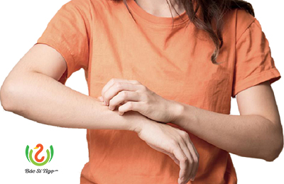 nổi mề đay nên lưu ý những gì