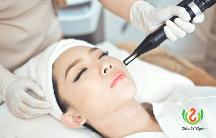 Điều trị u mềm treo bằng laser CO2