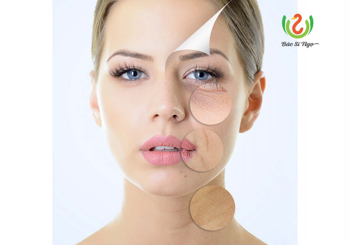 Làm thế nào để ngăn ngừa tăng sắc tố da