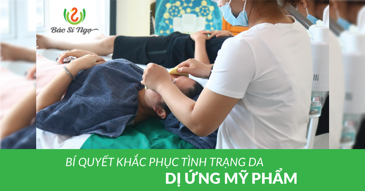 bí quyết khắc phục tình trạng da bị dị ứng mỹ phẩm