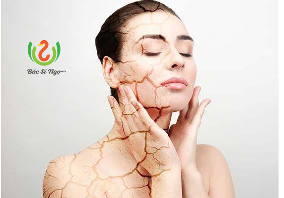Bí quyết khắc phục tình trạng da bị khô vào mùa hè