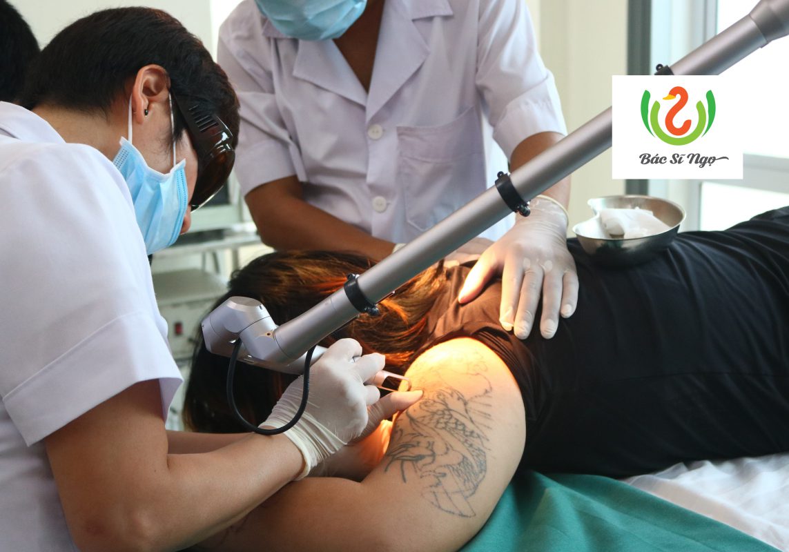 xóa xăm an toàn, không để lại sẹo