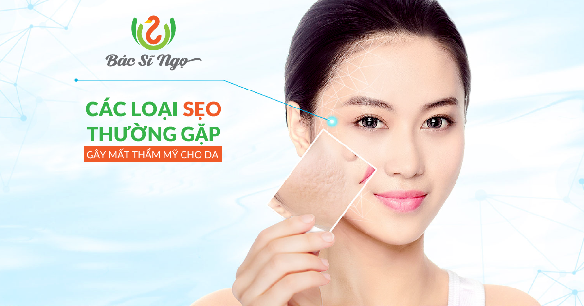 Các loại sẹo thường gặp gây mất thẩm mỹ cho da
