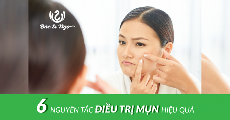 06 Nguyên tắc điều trị mụn hiệu quả