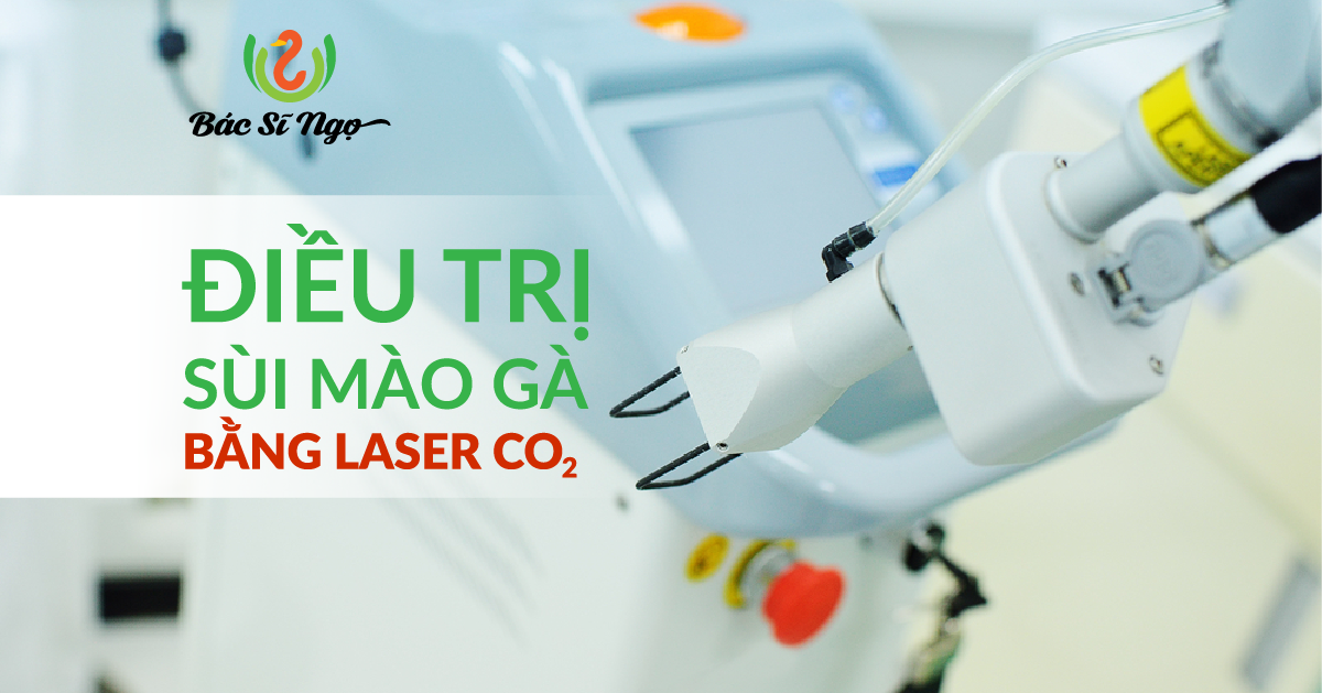 Điều trị sùi mào gà bằng laser CO2