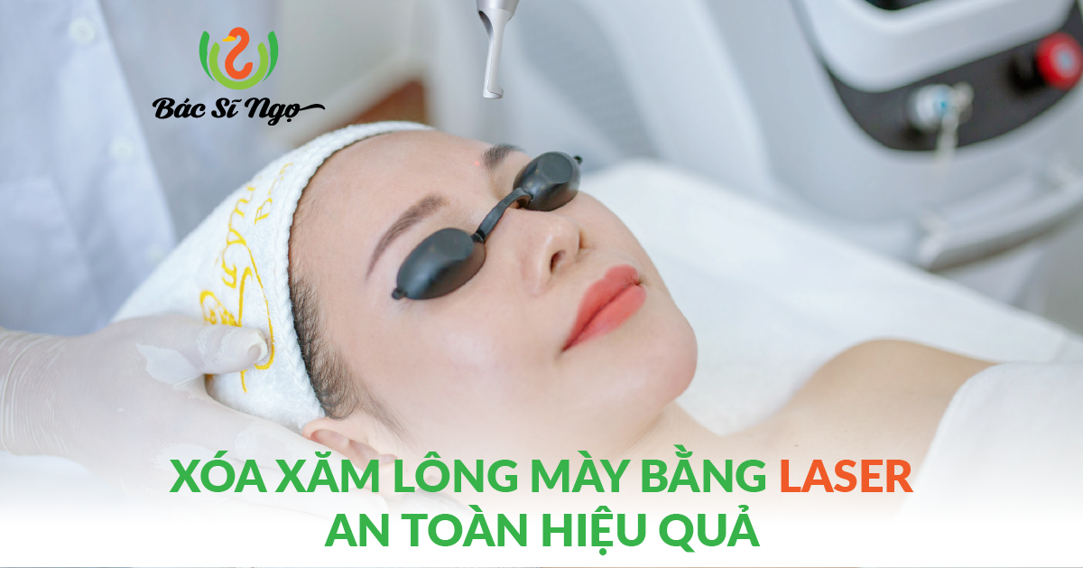 Xóa xăm lông mày bằng laser