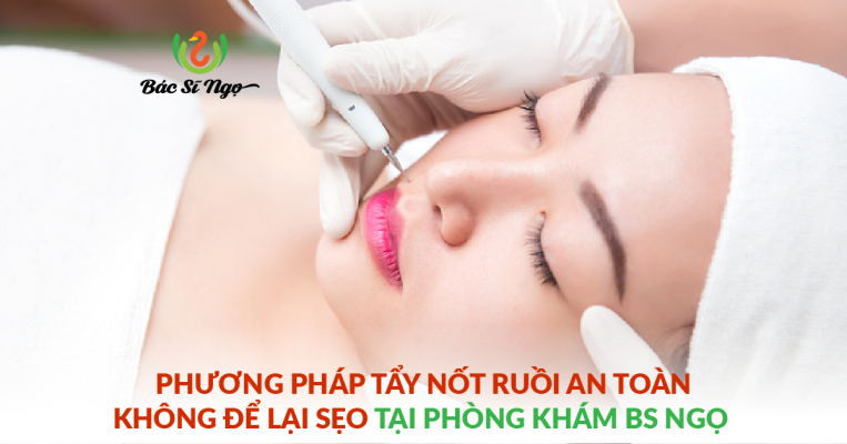 phương pháp tẩy nốt ruồi an toàn
