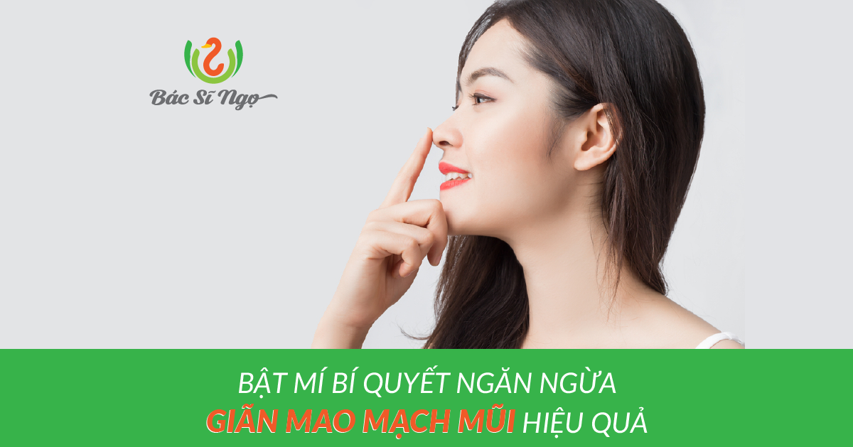 Bật mí bí quyết ngăn ngừa giãn mao mạch mũi hiệu quả