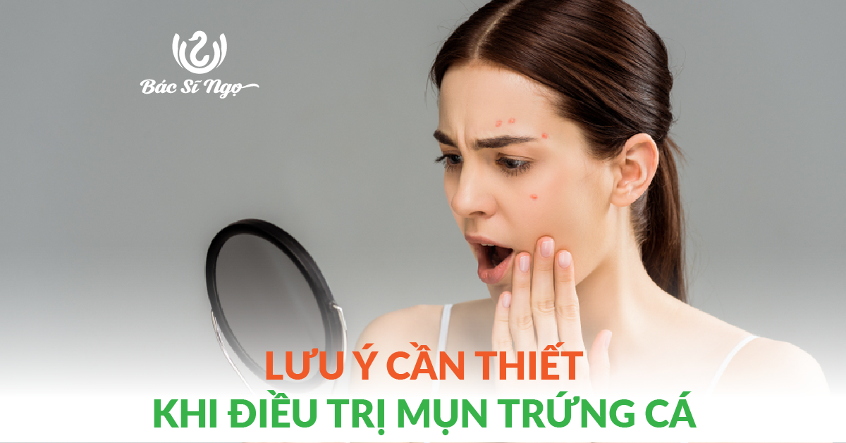 Lưu ý cần thiết khi điều trị mụn trứng cá