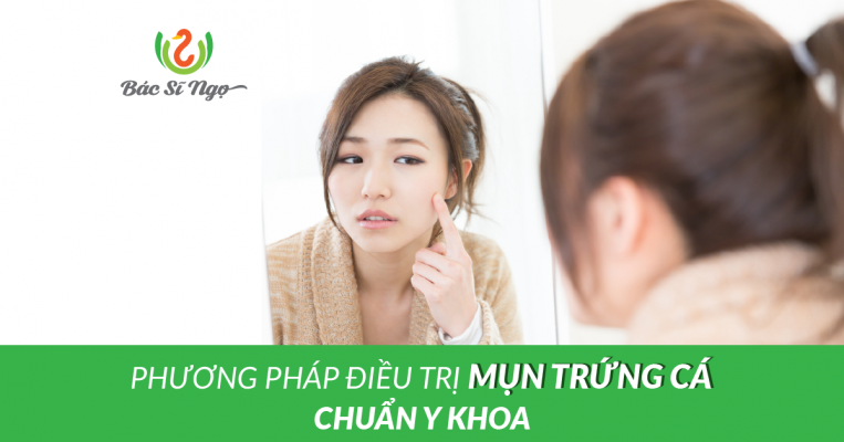 điều trị mụn trứng cá