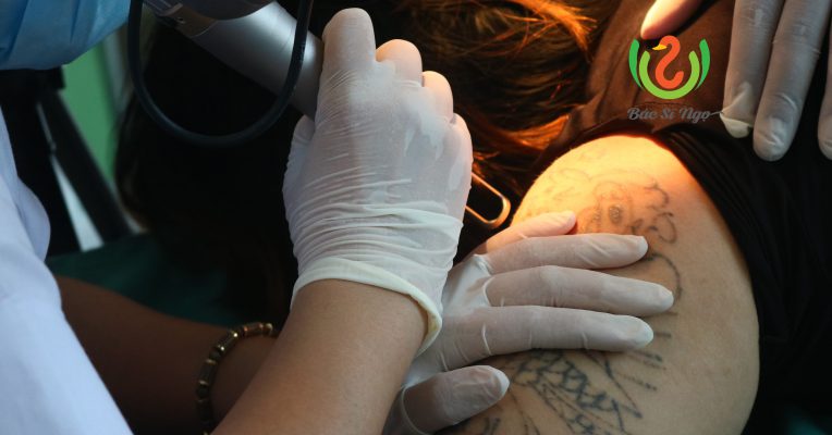 bệnh về da khi xăm