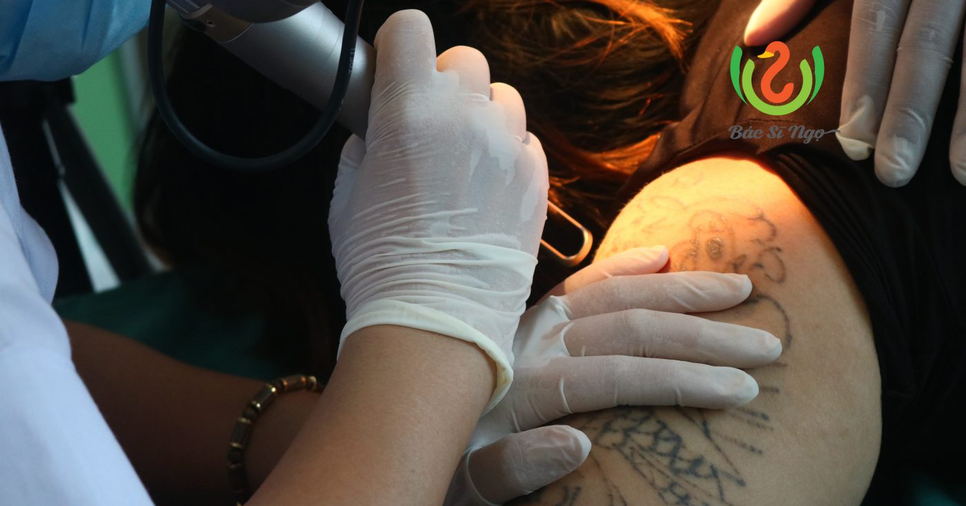 bệnh về da khi xăm