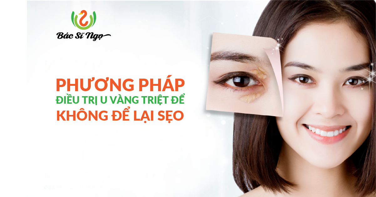 PHƯƠNG PHÁP ĐIỀU TRỊ U VÀNG TRIỆT ĐỂ, KHÔNG ĐỂ LẠI SẸO