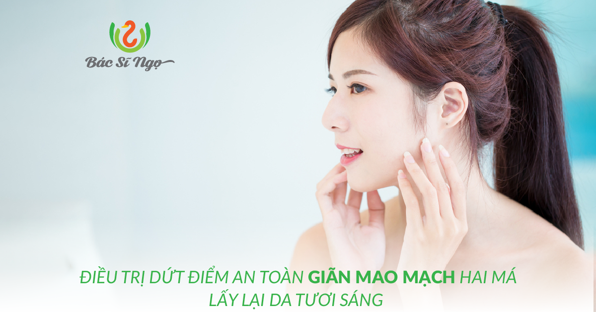 ĐIỀU TRỊ DỨT ĐIỂM AN TOÀN GIÃN MAO MẠCH HAI MÁ, LẤY LẠI Làn DA TƯƠI SÁNG