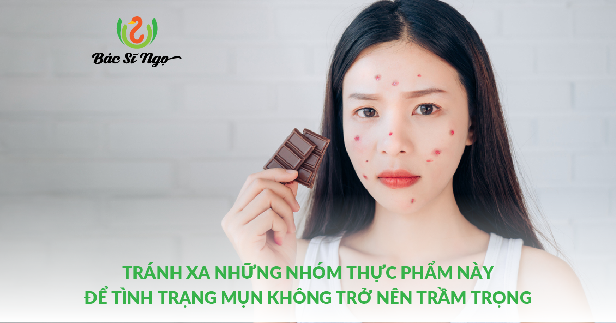 TRÁNH XA NHỮNG NHÓM THỰC PHẨM NÀY ĐỂ TÌNH TRẠNG MỤN KHÔNG TRỞ NÊN TRẦM TRỌNG