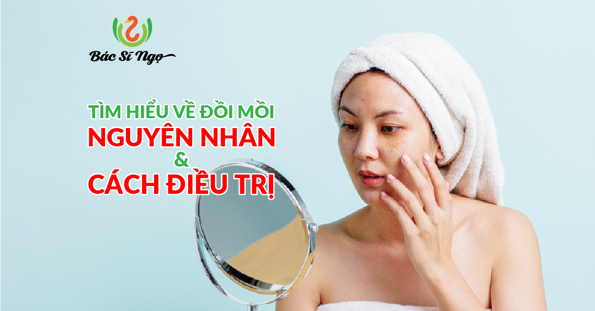 đồi mồi nguyên nhân và cách điều trị