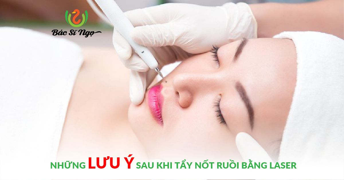 những lưu ý sau khi tẩy nốt ruồi bằng laser