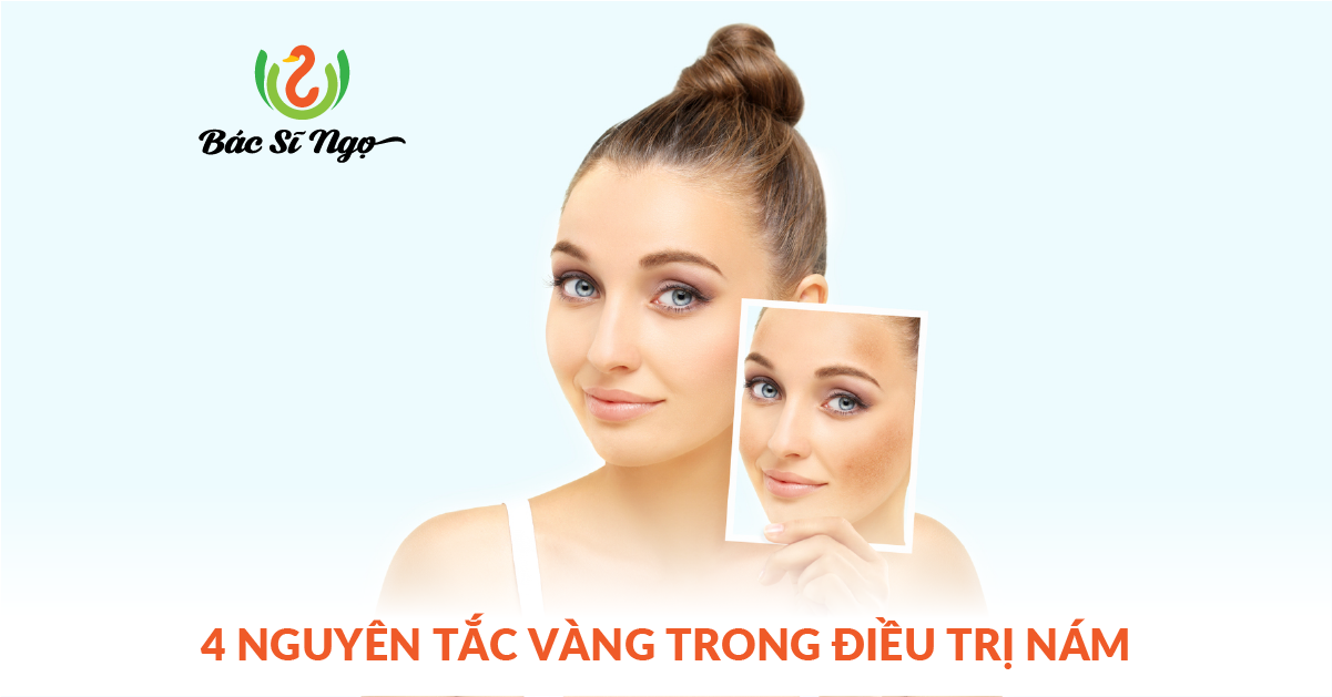 nguyên tắc vàng trong điều trị nám