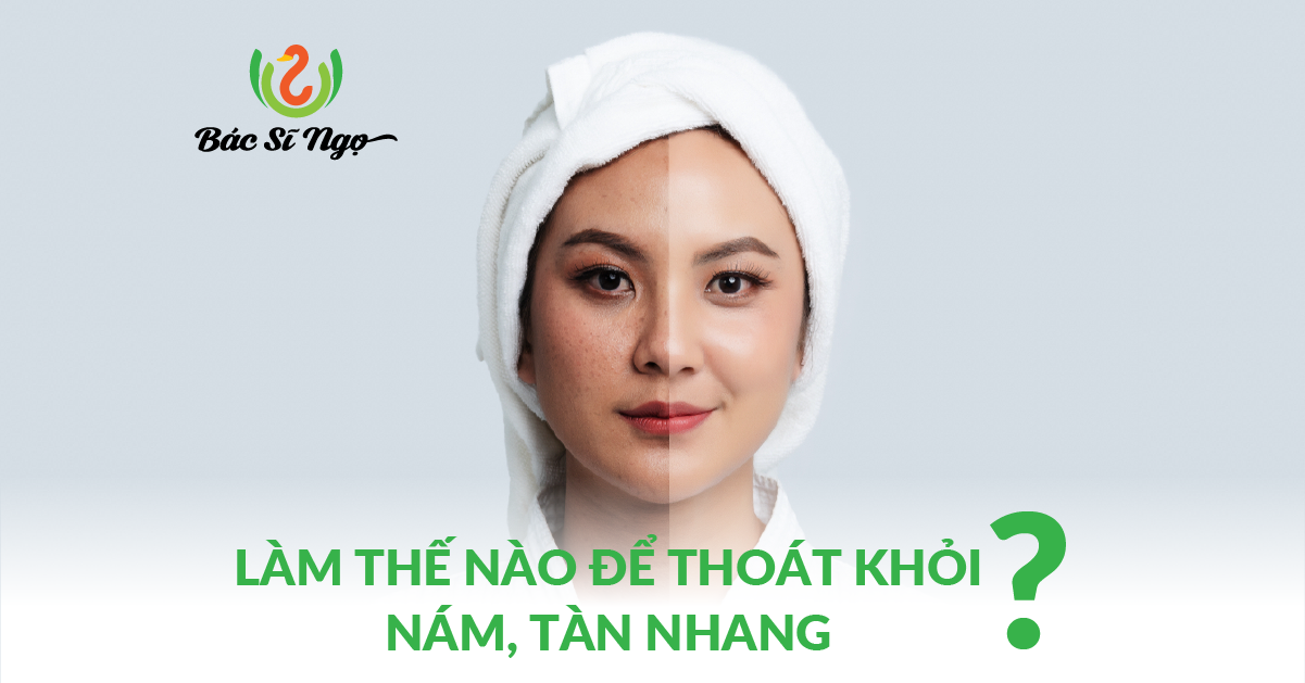 Làm thế nào để thoát khỏi nám tàn nhang