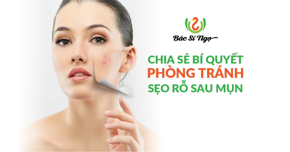 bí quyết phòng tránh sẹo rỗ sau mụn