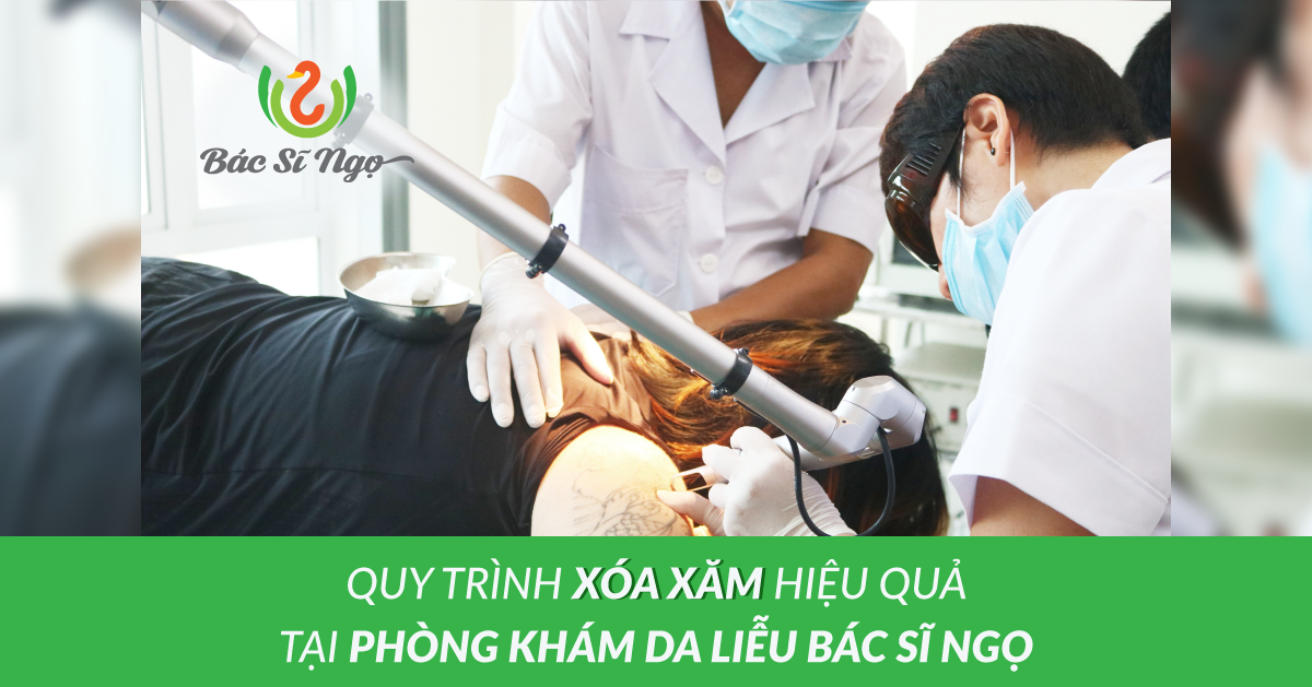 Quy trình xóa xăm hiệu quả