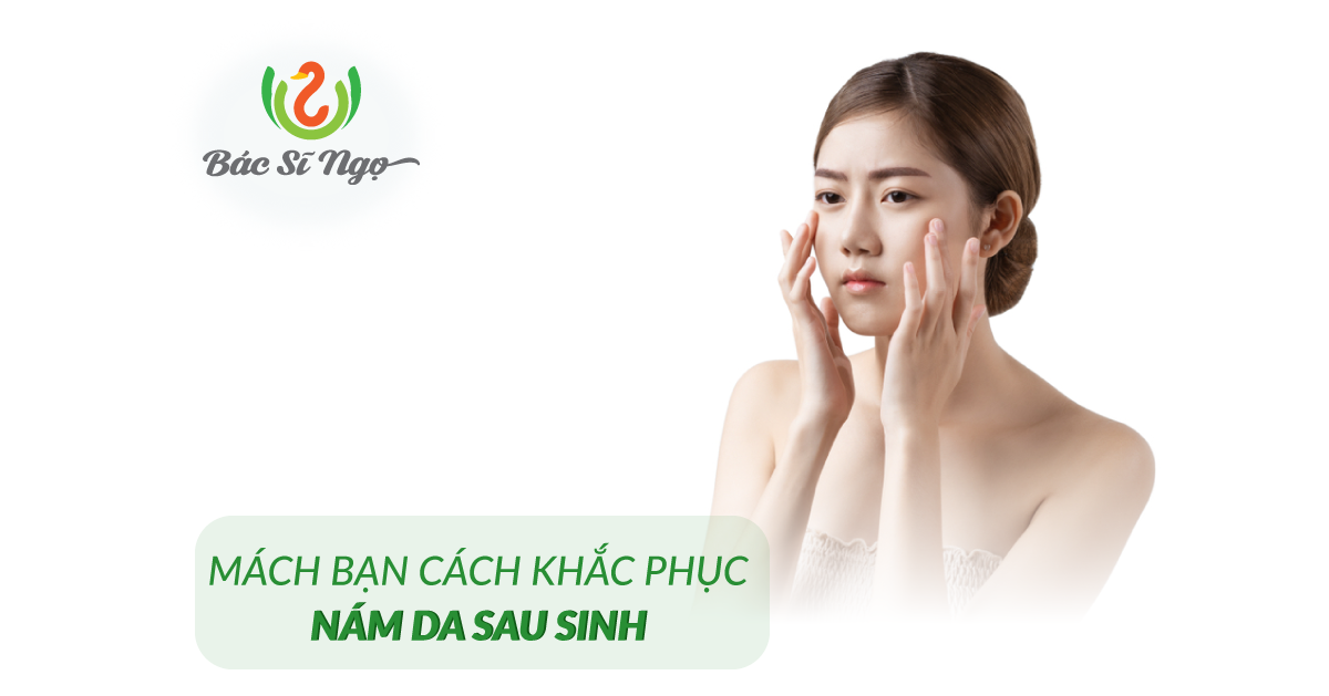 cách khắc phục nám da sau sinh