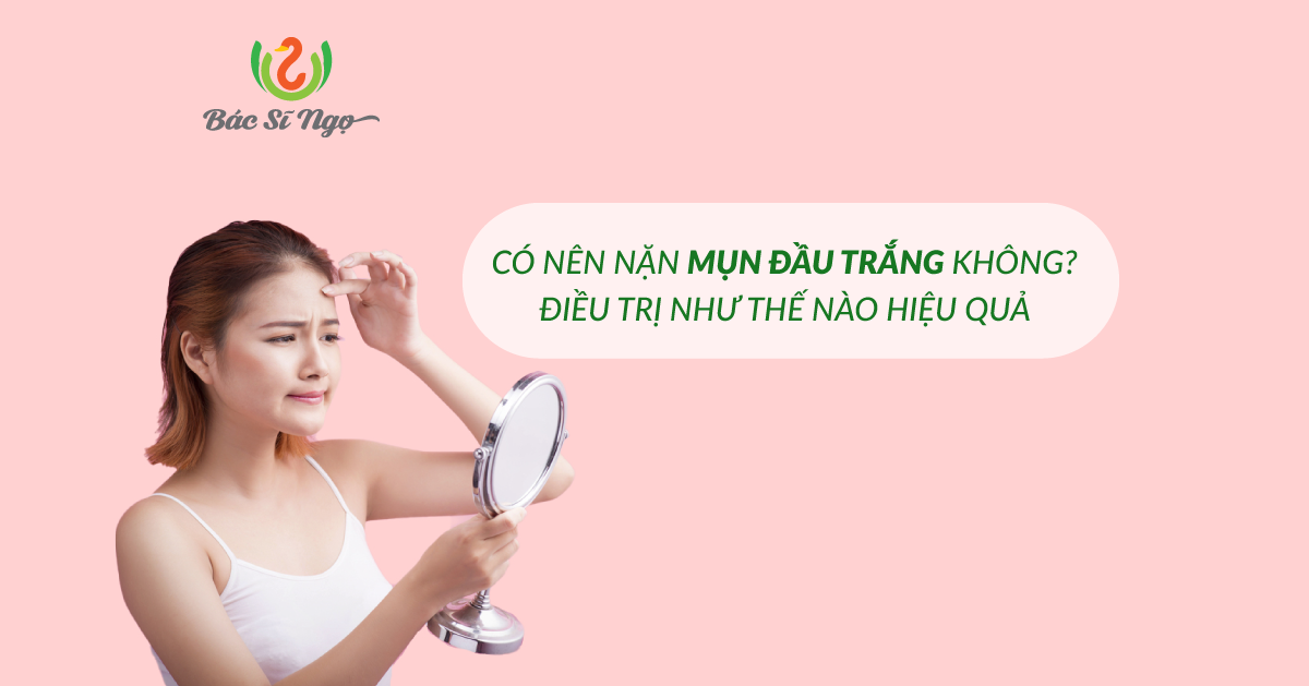 Có nên nặn mụn đầu trắng không