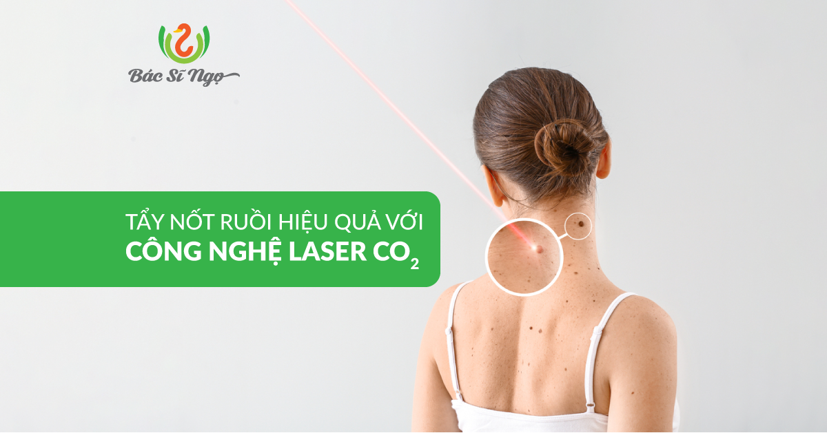 tẩy nốt ruồi hiệu quả