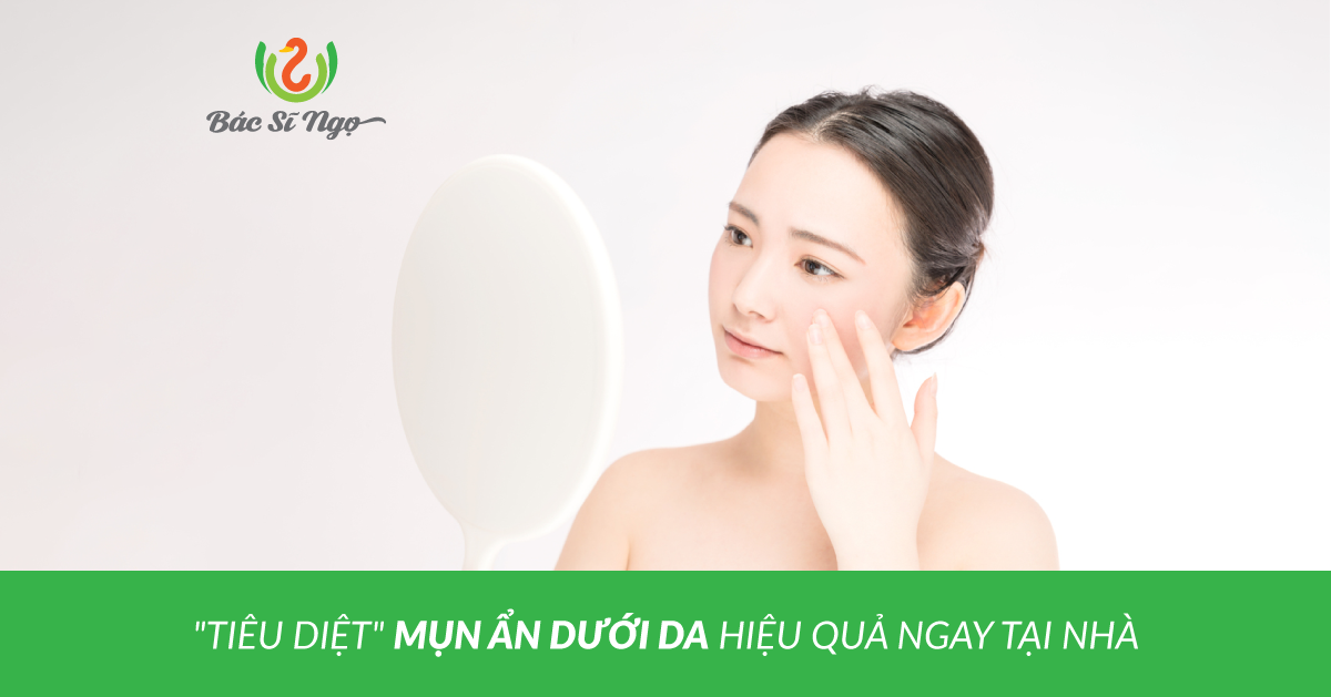 Tiêu diệt mụn ẩn dưới da