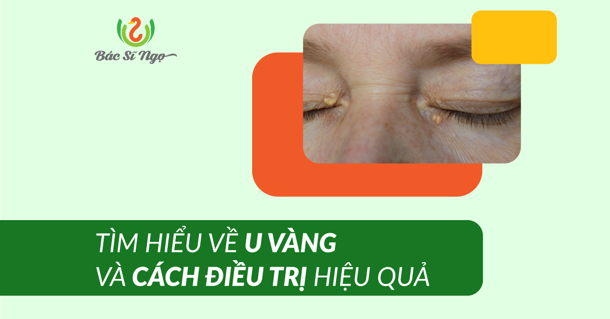 Tìm hiểu về u vàng
