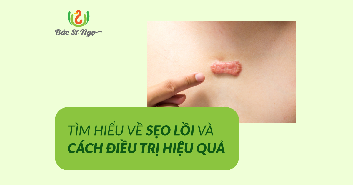sẹo lồi và cách điều trị