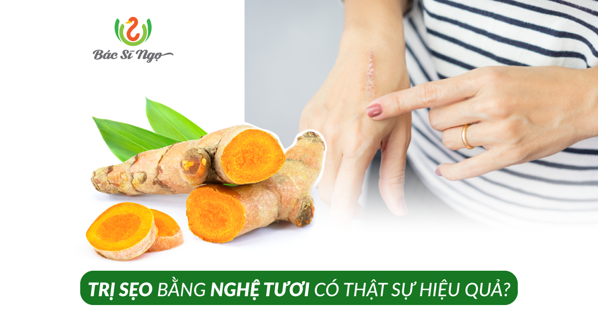 trị sẹo bằng nghệ tươi